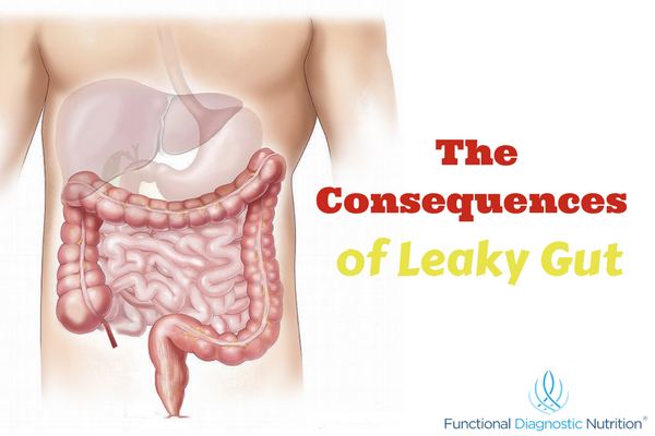 The Consequences of Leaky Gut