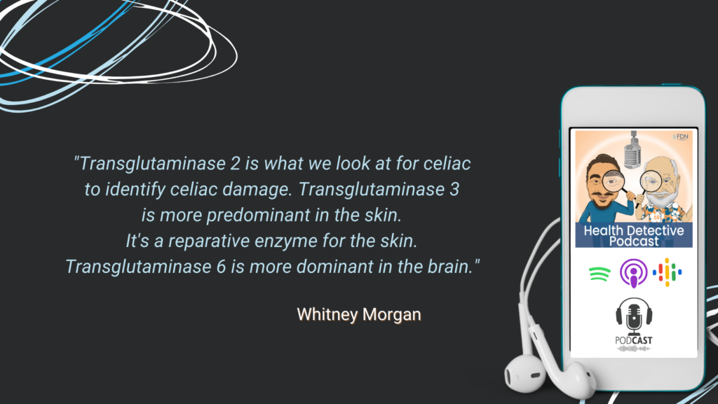 THE WHEAT ZOOMER, TRANSGLUTAMINASE 2, CELIAC DAMAGE, TRANSGLUTAMINASE 3, PREDOMINANT IN THE SKIN, REPARATIVE ENZYME, TRANSGLUTAMINASE 6, DOMINANT IN THE BRAIN