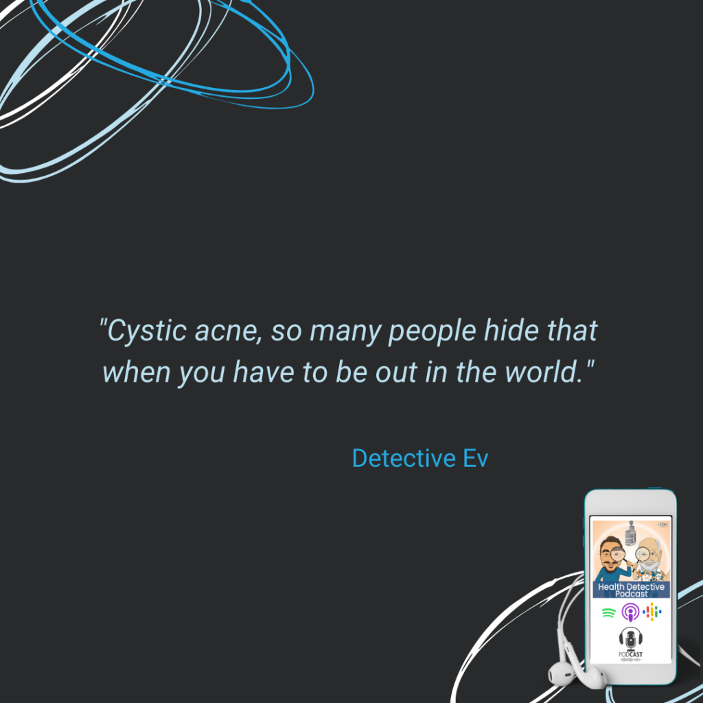 CYSTIC ACNE SUFFERERS HIDE, FDN, FDNTRAINING, HEALTH DETECTIVE PODCAST