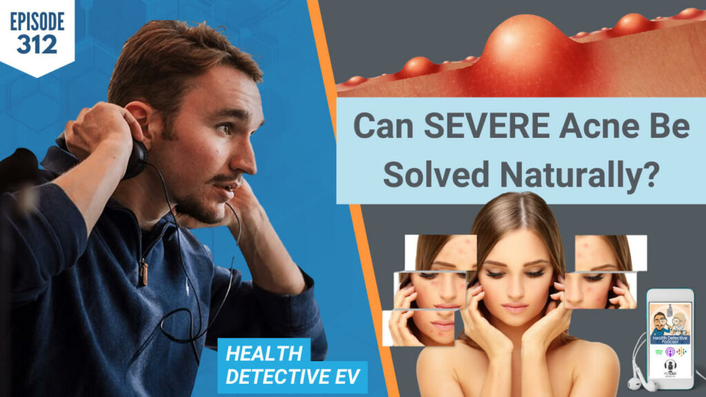 SEVERE ACNE, ACNE, SKIN HEALTH, SKIN ISSUES, LIGHT, CIRCADIAN RHYTHM, HORMONES, DIET, REST, NATURAL HEALTH, NATURAL HEALING, DETECTIVE EV, EVAN TRANSUE, BUCKS COUNTY LIGHT THERAPY, FDN, FDNTRAINING, HEALTH DETECTIVE PODCAST, HEALTH, HEALTH COACH, FUNCTIONAL LABS, LAB DATA, HEALTH TIPS