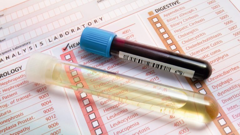 The Definitive Guide to Interpreting Functional Lab Tests: Beyond ...